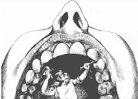 Zeichnung - Zahnarzt behandelt Zhne